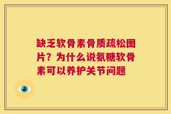缺乏软骨素骨质疏松图片？为什么说氨糖软骨素可以养护关节问题