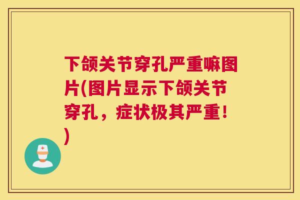 下颌关节穿孔严重嘛图片(图片显示下颌关节穿孔，症状极其严重！)