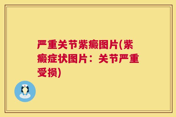 严重关节紫癜图片(紫癜症状图片：关节严重受损)