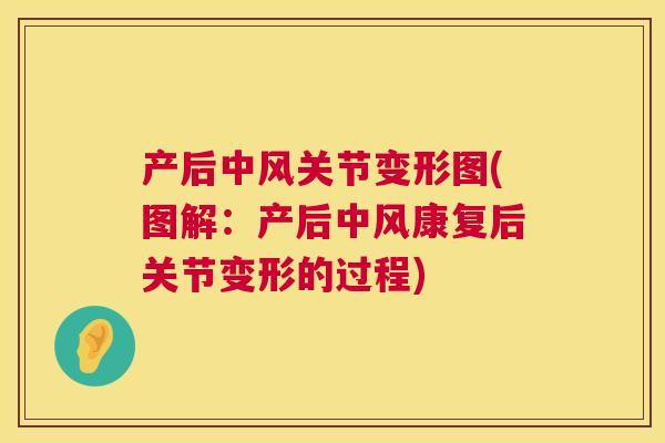 产后中风关节变形图(图解：产后中风康复后关节变形的过程)