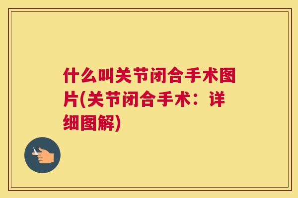 什么叫关节闭合手术图片(关节闭合手术：详细图解)