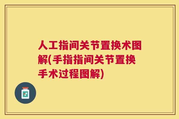 人工指间关节置换术图解(手指指间关节置换手术过程图解)