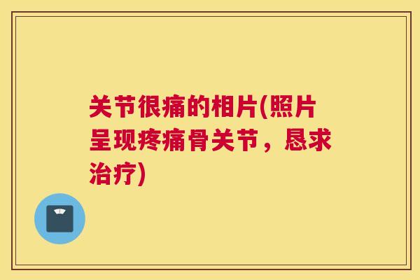 关节很痛的相片(照片呈现疼痛骨关节，恳求治疗)