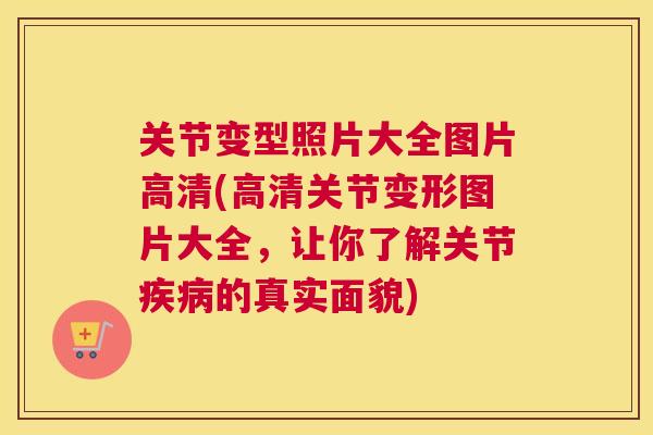 关节变型照片大全图片高清(高清关节变形图片大全，让你了解关节疾病的真实面貌)