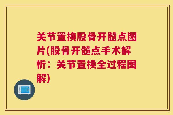 关节置换股骨开髓点图片(股骨开髓点手术解析：关节置换全过程图解)