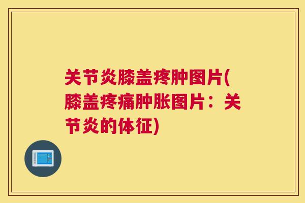 关节炎膝盖疼肿图片(膝盖疼痛肿胀图片：关节炎的体征)