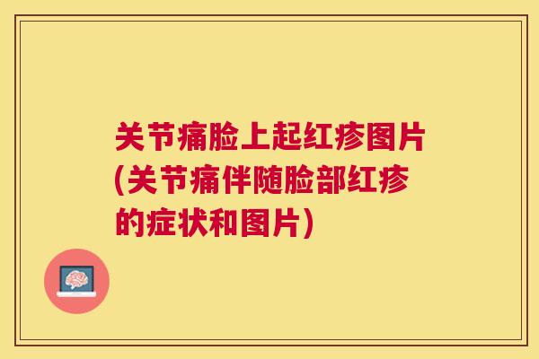 关节痛脸上起红疹图片(关节痛伴随脸部红疹的症状和图片)