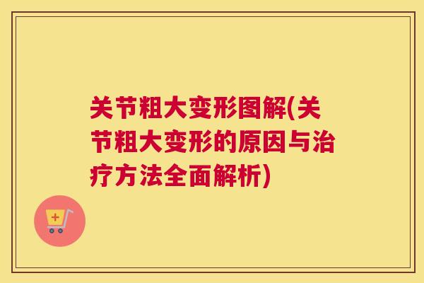 关节粗大变形图解(关节粗大变形的原因与治疗方法全面解析)