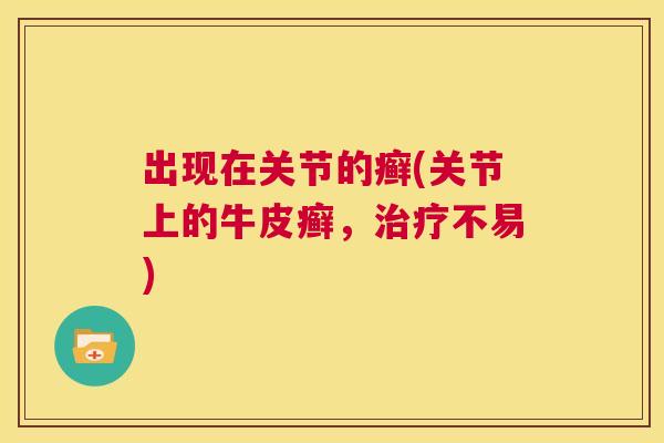 出现在关节的癣(关节上的牛皮癣，治疗不易)