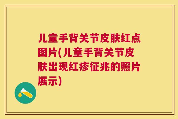 儿童手背关节皮肤红点图片(儿童手背关节皮肤出现红疹征兆的照片展示)