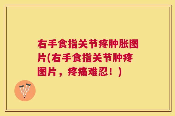 右手食指关节疼肿胀图片(右手食指关节肿疼图片，疼痛难忍！)