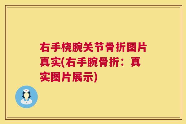 右手桡腕关节图片真实(右手腕：真实图片展示)