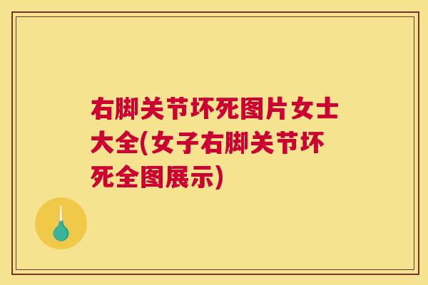 右脚关节坏死图片女士大全(女子右脚关节坏死全图展示)