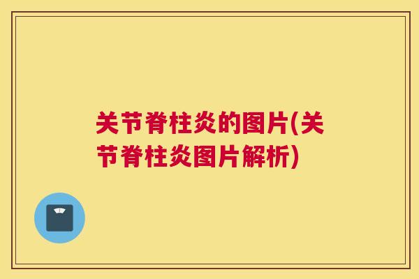 关节脊柱炎的图片(关节脊柱炎图片解析)