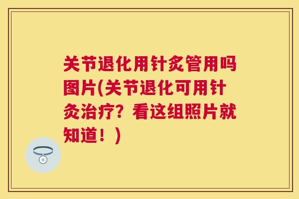 关节退化用针炙管用吗图片(关节退化可用针灸治疗？看这组照片就知道！)