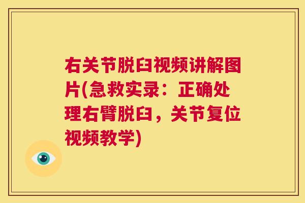 右关节脱臼视频讲解图片(急救实录：正确处理右臂脱臼，关节复位视频教学)