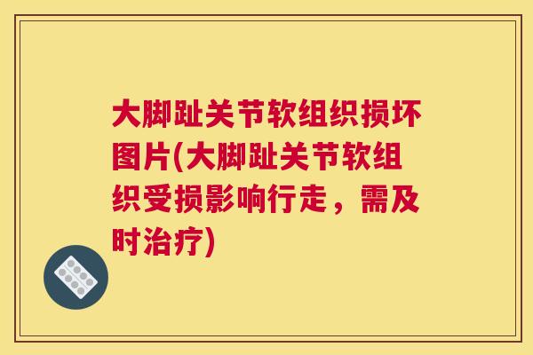 大脚趾关节软组织损坏图片(大脚趾关节软组织受损影响行走，需及时治疗)