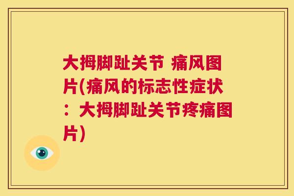 大拇脚趾关节 痛风图片(痛风的标志性症状：大拇脚趾关节疼痛图片)