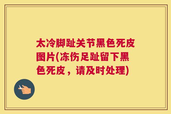 太冷脚趾关节黑色死皮图片(冻伤足趾留下黑色死皮，请及时处理)