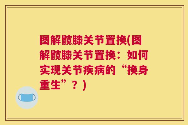 图解髋膝关节置换(图解髋膝关节置换：如何实现关节疾病的“换身重生”？)