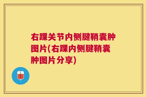 右踝关节内侧腱鞘囊肿图片(右踝内侧腱鞘囊肿图片分享)