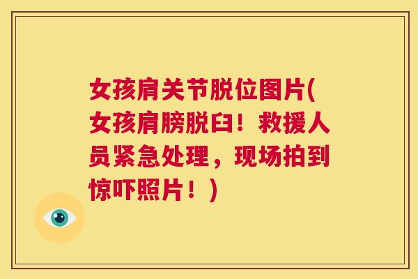 女孩肩关节脱位图片(女孩肩膀脱臼!救援人员紧急处理,现场拍到惊吓照片!) 女孩肩关节脱位图片(女孩肩膀脱臼!救援人员紧急处理,现场拍到惊吓照片!)