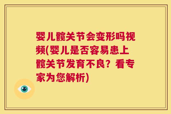 婴儿髋关节会变形吗视频(婴儿是否容易患上髋关节发育不良？看专家为您解析)