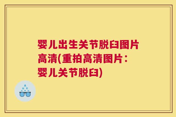 婴儿出生关节脱臼图片高清(重拍高清图片：婴儿关节脱臼)