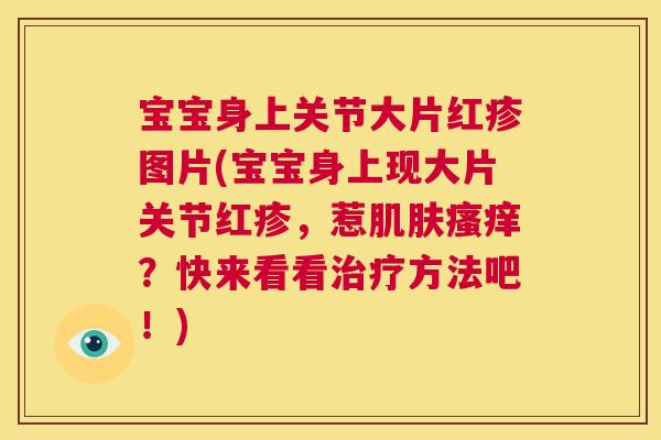 宝宝身上关节大片红疹图片(宝宝身上现大片关节红疹，惹？快来看看方法吧！)