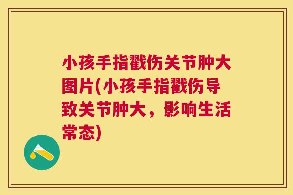 小孩手指戳伤关节肿大图片(小孩手指戳伤导致关节肿大，影响生活常态)