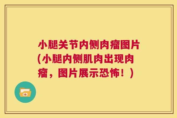 小腿关节内侧肉瘤图片(小腿内侧肌肉出现肉瘤，图片展示恐怖！)