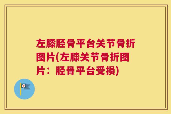 左膝胫骨平台关节骨折图片(左膝关节骨折图片：胫骨平台受损)
