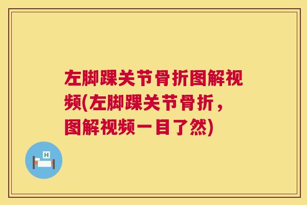 左脚踝关节骨折图解视频(左脚踝关节骨折，图解视频一目了然)