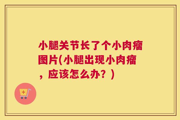 小腿关节长了个小肉瘤图片(小腿出现小肉瘤,应该怎么办?) 小腿关节长了个小肉瘤图片(小腿出现小肉瘤,应该怎么办?)