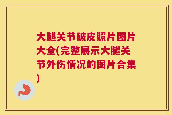 大腿关节破皮照片图片大全(完整展示大腿关节外伤情况的图片合集)