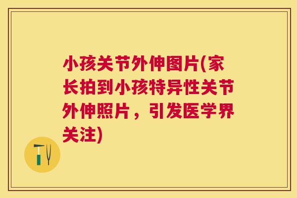 小孩关节外伸图片(家长拍到小孩特异性关节外伸照片，引发医学界关注)
