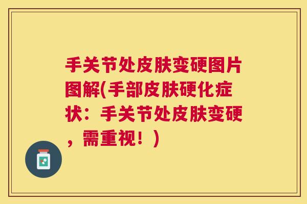 手关节处皮肤变硬图片图解(手部皮肤硬化症状：手关节处皮肤变硬，需重视！)