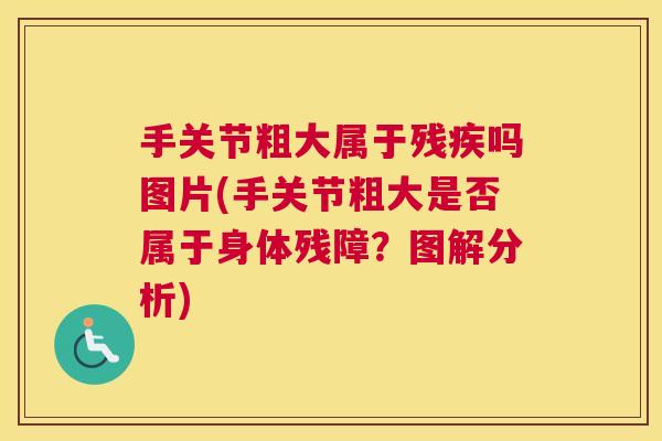 手关节粗大属于残疾吗图片(手关节粗大是否属于身体残障？图解分析)
