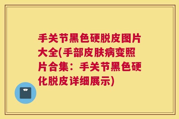 手关节黑色硬脱皮图片大全(手部皮肤病变照片合集：手关节黑色硬化脱皮详细展示)