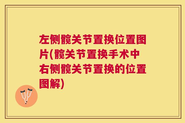 左侧髋关节置换位置图片(髋关节置换手术中右侧髋关节置换的位置图解)