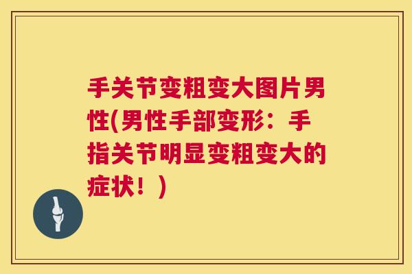 手关节变粗变大图片男性(男性手部变形：手指关节明显变粗变大的症状！)