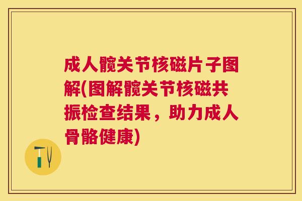 成人髋关节核磁片子图解(图解髋关节核磁共振检查结果，助力成人骨骼健康)