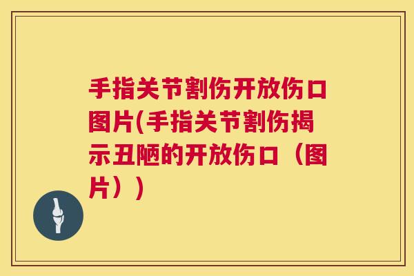 手指关节割伤开放伤口图片(手指关节割伤揭示丑陋的开放伤口（图片）)