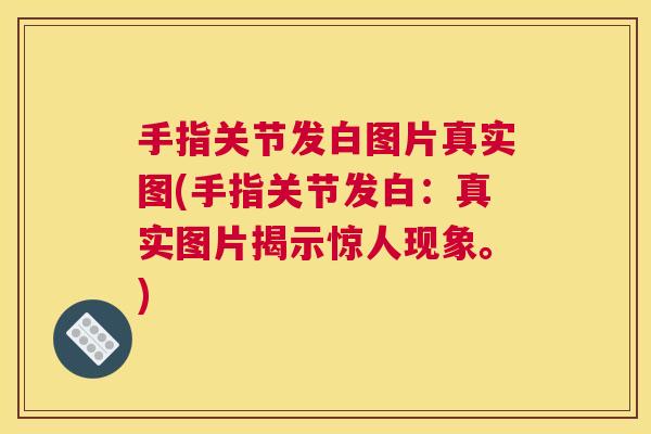 手指关节发白图片真实图(手指关节发白：真实图片揭示惊人现象。)