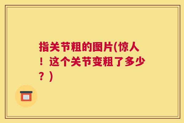 指关节粗的图片(惊人！这个关节变粗了多少？)
