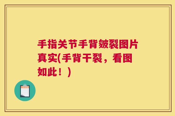 手指关节手背皴裂图片真实(手背干裂，看图如此！)