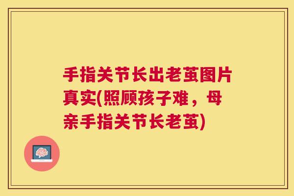 手指关节长出老茧图片真实(照顾孩子难，母亲手指关节长老茧)
