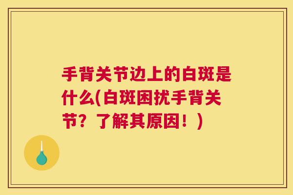 手背关节边上的白斑是什么(白斑困扰手背关节？了解其原因！)
