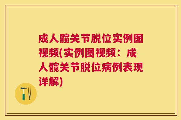 成人髋关节脱位实例图视频(实例图视频：成人髋关节脱位病例表现详解)