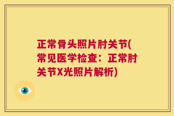 正常骨头照片肘关节(常见医学检查：正常肘关节X光照片解析)